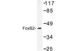 Image no. 1 for anti-Forkhead Box B2 (FOXB2) antibody (ABIN317907) (FOXB2 Antikörper)