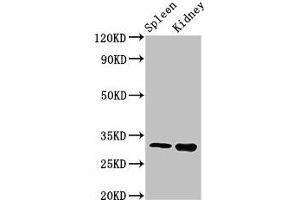 Western Blot Positive WB detected in: Mouse spleen tissue, Mouse kidney tissue All lanes: ABT1 antibody at 3 μg/mL Secondary Goat polyclonal to rabbit IgG at 1/50000 dilution Predicted band size: 32 kDa Observed band size: 32 kDa (Activator of Basal Transcription 1 Antikörper  (AA 197-270))