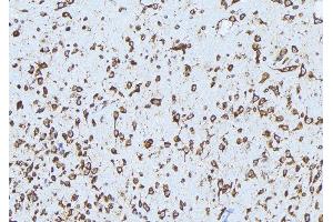 ABIN6279159 at 1/100 staining Mouse brain tissue by IHC-P. (ABCA3 Antikörper  (Internal Region))