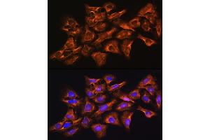 Immunofluorescence (IF) image for anti-Guanine Nucleotide Binding Protein (G Protein), beta Polypeptide 1 (GNB1) (AA 1-340) antibody (ABIN6141219)