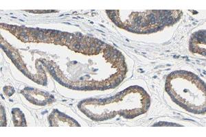 ABIN6279191 at 1/100 staining Human prostate tissue by IHC-P.