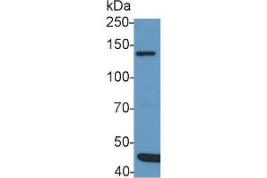 Detection of IRS1 in Rat Cerebrum lysate using Polyclonal Antibody to Insulin Receptor Substrate 1 (IRS1) (IRS1 Antikörper  (AA 837-1089))