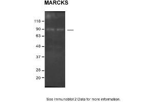 Sample: SH-SY5Y cells 2. (MARCKS Antikörper  (C-Term))