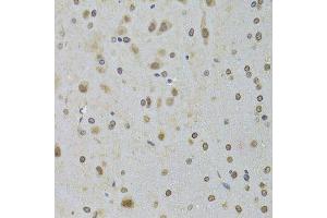 Immunohistochemistry (Paraffin-embedded Sections) (IHC (p)) image for anti-DEAD (Asp-Glu-Ala-Asp) Box Polypeptide 1 (DDX1) (AA 441-740) antibody (ABIN6139477)