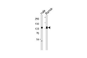 Western blot analysis of lysates from Hela, Ramos cell line (from left to right), using SP1 Antibody (ABIN1944791 and ABIN2838536). (SP1 Antikörper  (AA 1-250))
