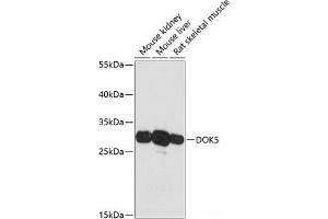 Western blot analysis of extracts of various cell lines using DOK5 Polyclonal Antibody at dilution of 1:3000. (DOK5 Antikörper)