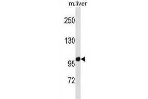 Western Blotting (WB) image for anti-Zinc Finger Protein 865 (ZNF865) antibody (ABIN5020901) (ZNF865 Antikörper)