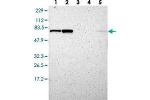 Western blot analysis of Lane 1: RT-4, Lane 2: U-251 MG, Lane 3: Human Plasma, Lane 4: Liver, Lane 5: Tonsil with RNGTT polyclonal antibody . (RNGTT Antikörper)