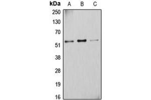 Western blot analysis of Cytochrome P450 2D6 expression in A431 (A), K562 (B), HuvEc (C) whole cell lysates.