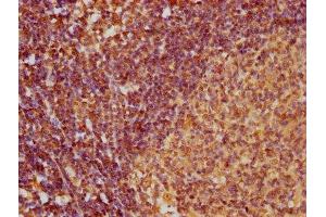 IHC image of ABIN7145992 diluted at 1:100 and staining in paraffin-embedded human lymph node tissue performed on a Leica BondTM system. (CCL27 Antikörper  (AA 25-112))