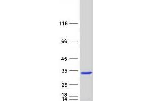 Validation with Western Blot