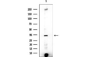 anti-Testis-Specific serine Kinase 1B (TSSK1B) (Internal Region) antibody