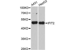 Western blot analysis of extracts of various cell lines, using IFIT2 antibody (ABIN6293343) at 1:3000 dilution. (IFIT2 Antikörper)