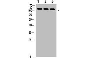 Western Blot analysis of 1,mouse-liver 2,hela 3,mouse-brain cells using primary antibody diluted at 1:1000(4 °C overnight). (SREBF1 Antikörper  (AA 250-330))