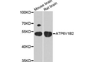 Western blot analysis of extracts of mouse brain and rat brain cell lines, using ATP6V1B2 antibody. (ATP6V1B2 Antikörper)