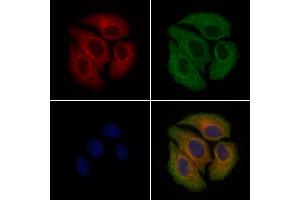 ABIN7093126 and ABIN7098645 staining Hela cells by IF/ICC. (Factor VII Antikörper)
