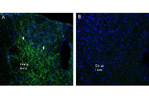 Free-floating frozen spinal cord sections from a paraformaldehyde-perfused rat were incubated with Anti-NaV1.