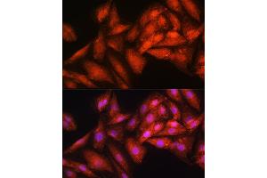 Immunofluorescence analysis of H9C2 cells using EXOSC2 Rabbit pAb (ABIN6127886, ABIN6140374, ABIN6140375 and ABIN6214708) at dilution of 1:100. (EXOSC2 Antikörper  (AA 1-293))