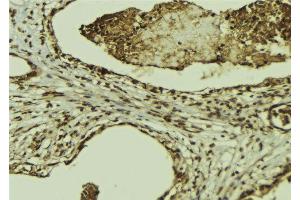 ABIN6269302 at 1/100 staining Mouse colon tissue by IHC-P.