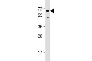 Western blot testing of human U-251 MG cell lysate with SH2B3 antibody at 1:2000.