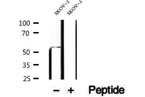 Western blot analysis of extracts of SKOV-3 cells, using PDHX antibody. (PDHX Antikörper)