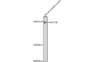 Western blot analysis of extracts of Mouse skeletal muscle, using MYH7B antibody (ABIN7268759) at 1:1000 dilution. (MYH7B Antikörper)