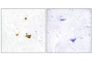 Immunohistochemistry analysis of paraffin-embedded human brain tissue, using EZH1 antibody.