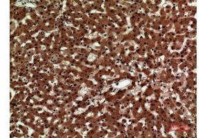 Immunohistochemistry (IHC) analysis of paraffin-embedded Human Liver, antibody was diluted at 1:100. (IL12A Antikörper  (Internal Region))
