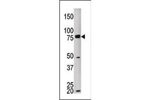 The anti-MELK Pab (ABIN391224 and ABIN2841298) is used in Western blot to detect MKEL in HEPG2 tissue lysate (MELK Antikörper  (C-Term))