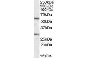 Western Blotting (WB) image for Potassium Voltage-Gated Channel, KQT-Like Subfamily, Member 1 (KCNQ1) peptide (ABIN369050)