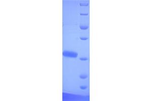 SDS-PAGE (SDS) image for TOX1 (AA 35-269) protein (His tag) (ABIN5714166) (TOX1 (AA 35-269) protein (His tag))