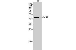 Western Blotting (WB) image for anti-Poliovirus Receptor (PVR) (Internal Region) antibody (ABIN3178974) (Poliovirus Receptor Antikörper  (Internal Region))