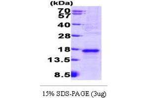 SDS-PAGE (SDS) image for VEGF 120/VEGFA (AA 27-146) (Active) protein (His tag) (ABIN667747)