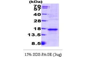 SDS-PAGE (SDS) image for Vascular Endothelial Growth Factor (VEGF) (AA 205-324) protein (His tag) (ABIN667747)