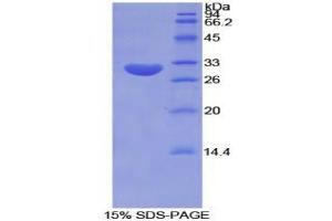 SDS-PAGE analysis of Mouse Tubulin epsilon Protein. (TUBE1 Protein)