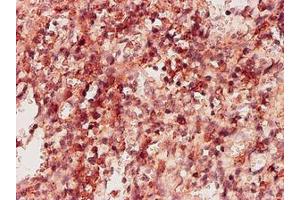 Image no. 1 for anti-Ketohexokinase (KHK) (AA 1-299) antibody (ABIN598769) (Ketohexokinase Antikörper  (AA 1-299))