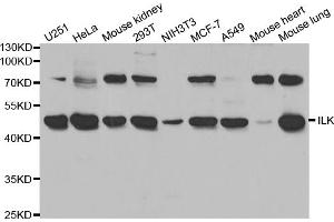 Western blot analysis of extracts of various cell lines, using ILK antibody (ABIN5970329) at 1/1000 dilution. (ILK Antikörper)