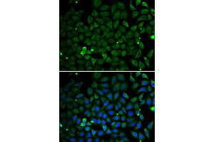 Immunofluorescence analysis of U2OS cell using PARK2 antibody. (Parkin Antikörper)
