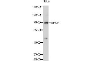 Western blot analysis of extracts of HeLa cells, using SPOP antibody (ABIN6292286) at 1:3000 dilution. (SPOP-B Antikörper)