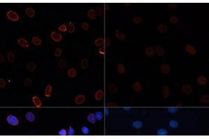 Immunofluorescence analysis of C6 cells using Acetyl-Histone H3-K56 Polyclonal Antibody at dilution of 1:100.