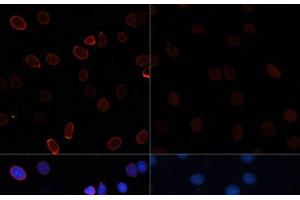 Immunofluorescence analysis of C6 cells using Acetyl-Histone H3-K56 Polyclonal Antibody at dilution of 1:100. (Histone 3 Antikörper  (acLys56))