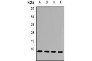 Western blot analysis of FAM96B expression in Hela (A), MCF7 (B), mouse heart (C), mouse testis (D) whole cell lysates.