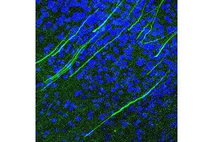 Immunostaining of mouse brain cortex identifying the calcium channels along axons stained with Anti-Cav1.