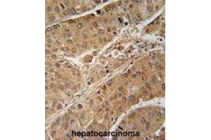 Immunohistochemistry (IHC) image for anti-Ribosomal Protein S6 Kinase, 70kDa, Polypeptide 2 (RPS6KB2) antibody (ABIN2909954) (RPS6KB2 Antikörper)