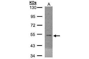 WB Image Sample(30 ug whole cell lysate) A:MOLT4 , 10% SDS PAGE antibody diluted at 1:3000 (EIF5 Antikörper)