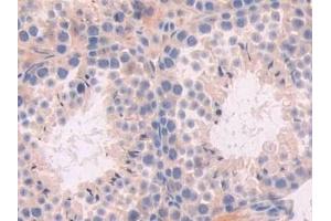 Immunohistochemistry (IHC) image for anti-Xanthine Dehydrogenase (XDH) (AA 231-416) antibody (ABIN7435052)
