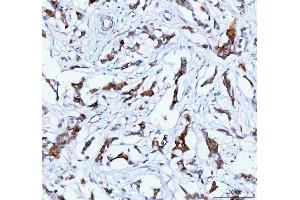 IHC analysis of TACI using anti-TACI antibody (ABIN5692816).