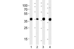 Western blot analysis of lysate from 1) 293, 2) RD, 3) mouse NIH3T3 and 4) rat L6 cell line using Aldolase antibody at 1:1000. (ALDOA Antikörper  (AA 66-95))