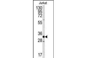 Western blot analysis of anti-CDK2 Antibody (C-term) (ABIN391746 and ABIN2841622) in Jurkat cell line lysates (35 μg/lane). (CDK2 Antikörper  (C-Term))