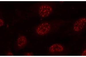 Immunofluorescence analysis of methanol-fixed HeLa cells using Phospho-MAPKAPK2(T334) Polyclonal Antibody (MAPKAP Kinase 2 Antikörper  (pThr334))